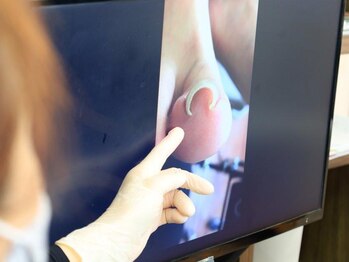 施術【1.状態を一緒に確認】