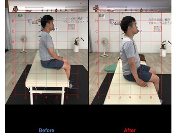 ストレチックス 近江八幡店/ストレッチ ビフォーアフター