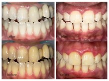 アルクローゼット(aru closet)の雰囲気(ビフォーアフター)