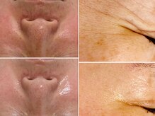 ボディメイキング キキ(Bodymaking KIKI)の雰囲気（肌の内側から改善を促すエイジングケアメニューが人気）