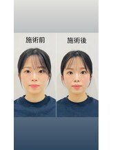 赤沼鍼灸整骨院/美・健康・笑顔に導く美容鍼