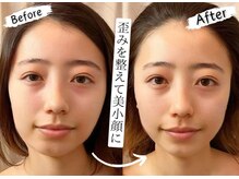 ビーキュート 学芸大学店(BE-CUTE)の雰囲気(効果にこだわる施術で根本改善を目指します!)