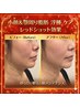 New♪【輪郭形成美人】　加齢二重顎　脂肪小顔フェイシャル体験 
