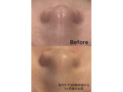 ロッカ(ROCCA..)の写真