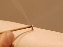 七彩鍼灸院/お灸【鍼灸/美容鍼/恵比寿】