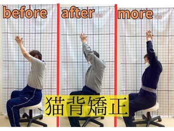 きずな鍼灸整骨院 武蔵ヶ丘本院/猫背矯正