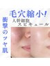 【ハーブを超えた！肌質激変☆】人幹細胞マイクロニードル導入で毛穴縮小！