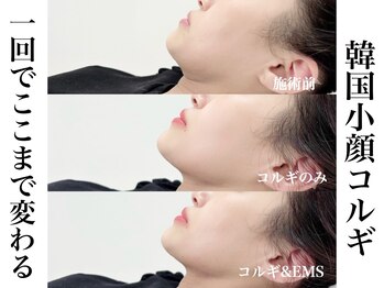 リベルキョウト 京都駅前店(Liber Kyoto)/韓国小顔コルギ