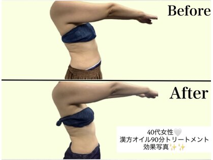 アオレニア(ao.lenia)の写真