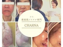 シャルナ(charna)