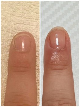 自爪育成プライベートサロン　Reginanail【レジーナネイル】/水仕事で深爪さんも２ヶ月で成長