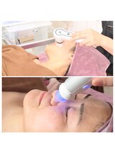 エム(M)/フェイシャル