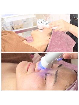 エム(M)/フェイシャル