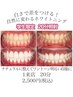 【学割U24】期間限定 高性能セルフホワイトニング 20分照射  2500円