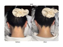 チョクチョクサロン(CHOKCHOK. Salon)/うなじMIX脱毛