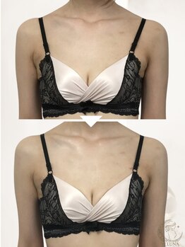ヴェルナ(VELUNA)/30代子育てママ育乳初回→3回目