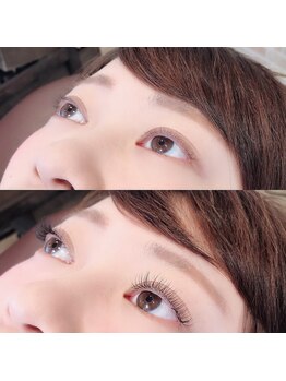 アイヴィー(ivy)/Before☆After
