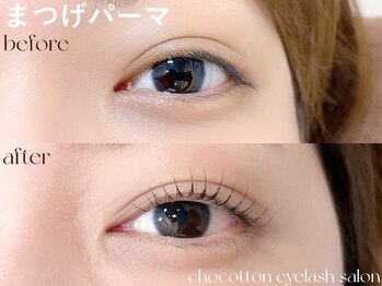 チョコットン 新宿東口(chocotton)/光を取り入れてうるうるな瞳に*