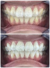 グラスプレイス/プレミアム症例　12