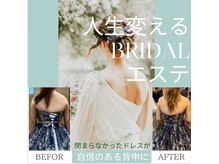 サロンド ヴィーナス 葛西店/二の腕★痩せブライダルエステ