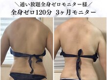 シーフェイス 横浜店(SEE FACE)/全身ゼロダイエットモニター様