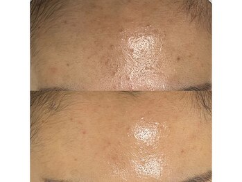 チュチュ(TUTU)/ララピール×美容乳酸菌