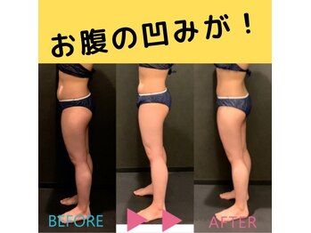 バーン 長崎 諫早(BURN)/ハイパーナイフbeforeafter☆