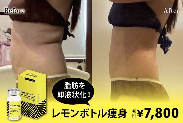 値下げしました！エステ　痩身　キャビテーション キャビテーションとラジオ波で痩せにくい部分痩せもしっかりカバー