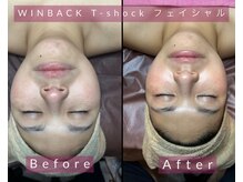 シストワ(sistoi)/ウィンバック【Before→After】