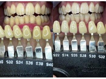 トウキョウスワーズ 池袋店(TOKYO SWRS)/#ホワイトニング #池袋 #渋谷