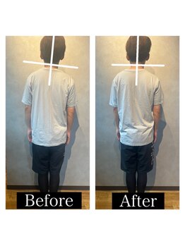 ルミナス/身体の歪み改善実績！