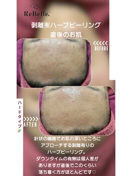 リベル(ReBelle.)/