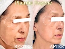 レイネ(REINE)/ファーマリジェネ/美肌三大要素