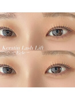 エクレ(Ecle)/まつパ◎ケラチンラッシュリフト