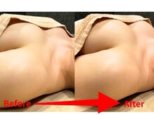アファン 鶴見店(Afun)/バストアップBeforeAfter