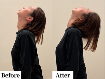 ソレア(Solea)/首こり改善1回目