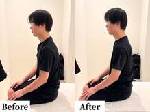 ソレア(Solea)/首こり・肩こり・巻き肩改善