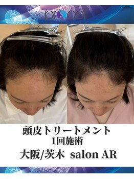 メンズサロンアール(AR)/プロセルセラピーズ