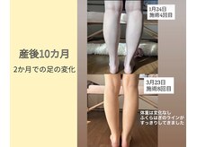 ルーナサナ(Luna sana)/産後骨盤矯正/脚のラインの変化