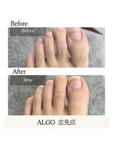 アルゴ 志免店(ALGO)/足元もキレイに♪