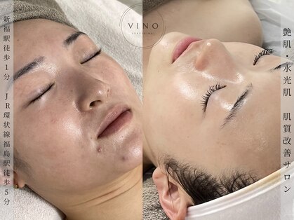 ヴィノ フクシマ(VINO fukushima)の写真