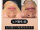 モデルズ 名古屋(MODELS)の写真/名古屋で一番得意なメンズ脱毛！ヒゲ脱毛で自信あふれる毎日を応援します。