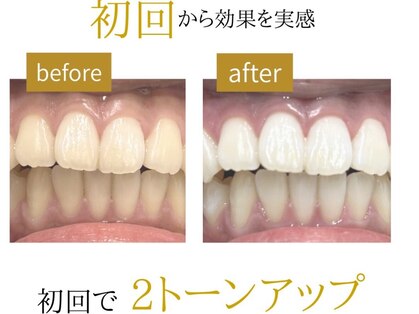 《医療提携×結果重視》ホワイトニングサロンMORE【岸和田/和泉】の写真