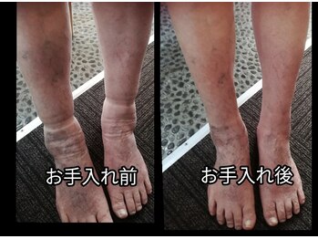 そら/リンパ/リンパマッサージ