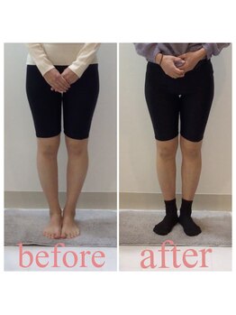 スタイルラボ高松/産後骨盤矯正の効果♪