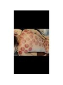 足優 赤坂(あしゆう)/カッピング!