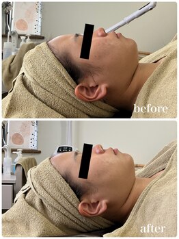 ジャスミン(Jasmin)/オーダーメイド高濃度原液導入