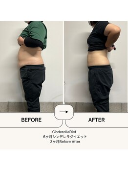 オーシャン整骨院(OCEAN整骨院)/６ヶ月コース