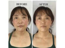 全身バランス矯正体験で、触れていない顔が10年前のお顔に変身