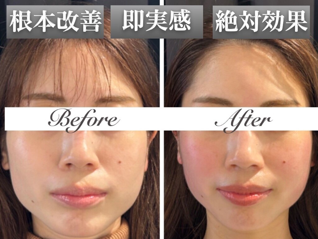 「Fascia Re:life」小顔調整法 セルフ小顔 予約のとれないエステティシャンが教える一生使える